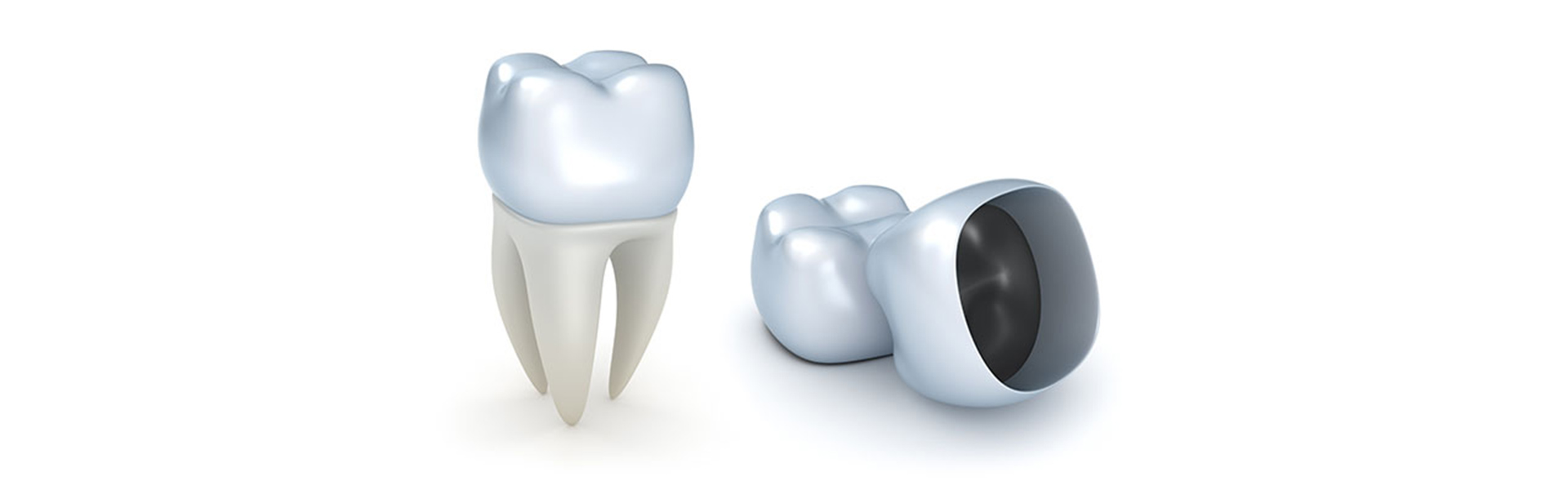 The Role of Dental Crowns in Modern Dentistry