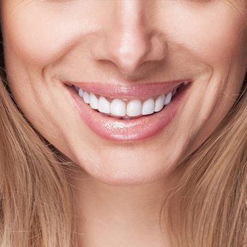 Why a Smile Makeover Could Be the Best Decision You Make